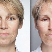 Les ravages sur le visage avec 2 heures de sommeil en moins en 5 jours